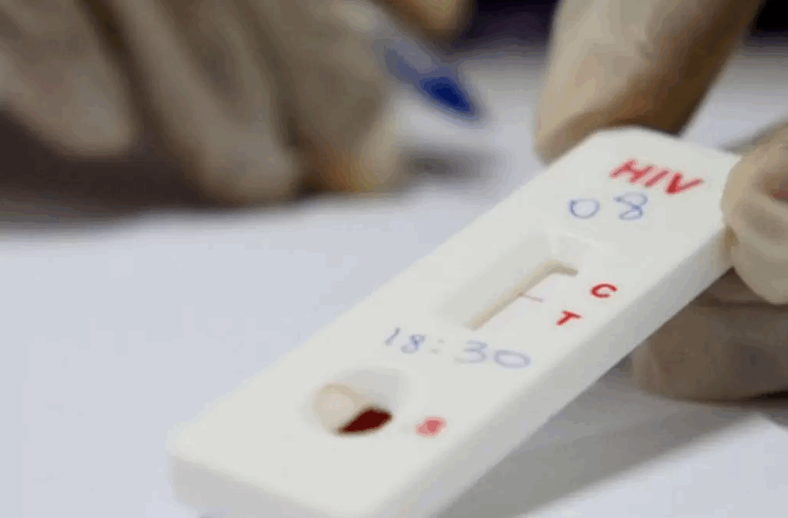 Prefeitura comete erro e publica lista de pacientes com HIV no Diário Oficial