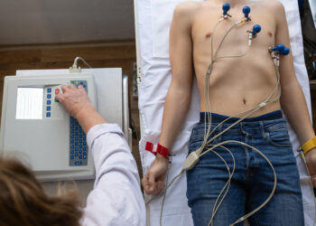 Ecocardiograma: exame simples pode ajudar a prevenir complicações cardíacas e apoiar um diagnóstico precoce