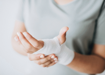 Curso de Fisioterapia da Unijorge realiza atendimento gratuito a pacientes queimados